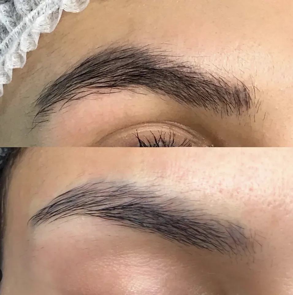 Eyebrow tattoo removal before and after Prescott AZ